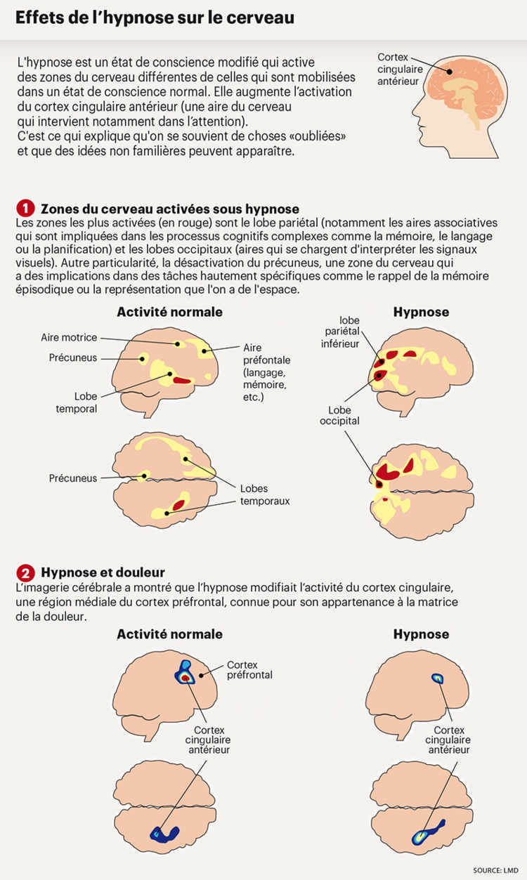 Effets de l'hypnose sur le cerveau